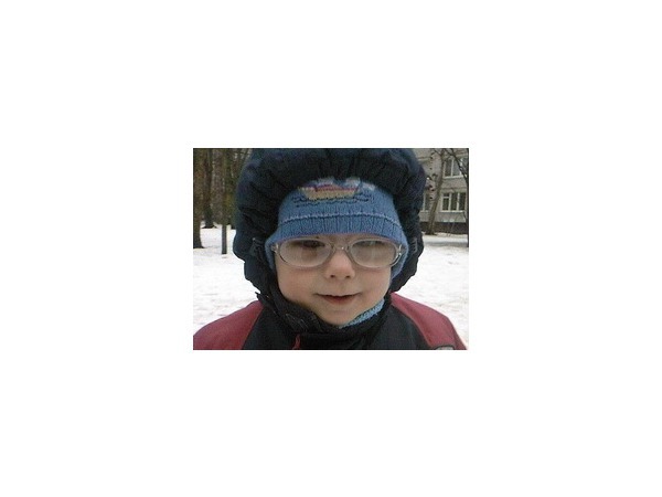 Двухлетний мальчик теряет зрение